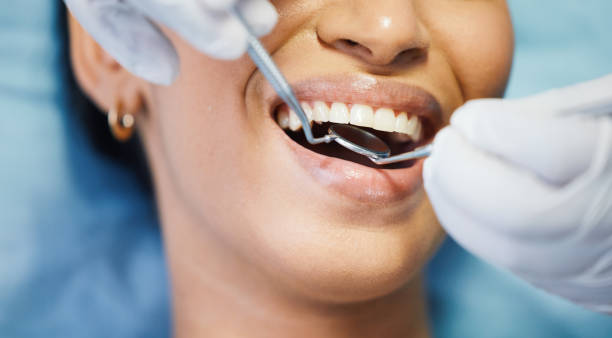  Deer Park, TX Emergency Dentist Pros